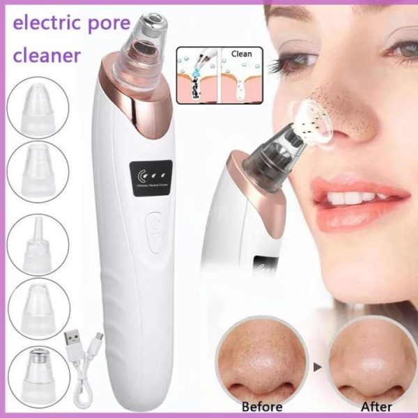 5 in 1 Blackheads Remover Pore Cleaner | Rechargeable